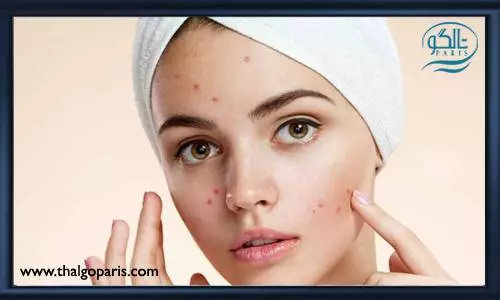 عدم استفاده از مصرف غذای چرب و ماسک کثیف