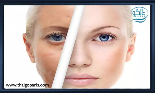 عوارض و مراقبت های پس از لایه برداری