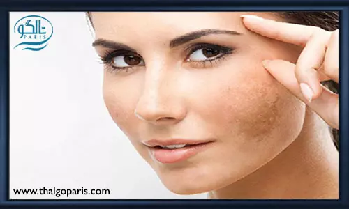 دلایل ایجاد لک بر روی صورت