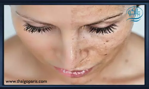 ایجاد لک بر روی صورت به چه علت است