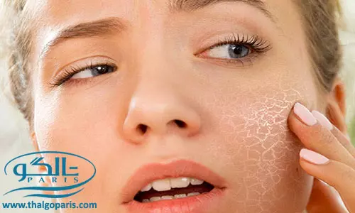 درمان خشکی پوست