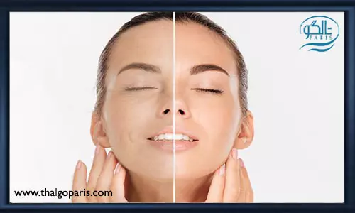 مزایای لایه برداری پوست با لیزر