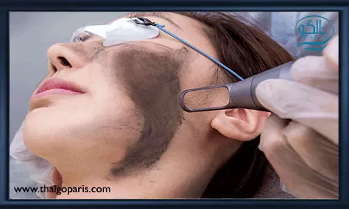 هزینه لایه برداری پوست با لیزر