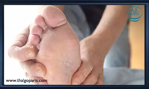 مراقبت از ترک پا در فصل سرد