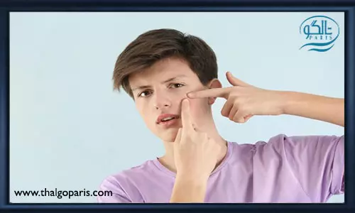 دلایل ایجاد جوش بر روی صورت