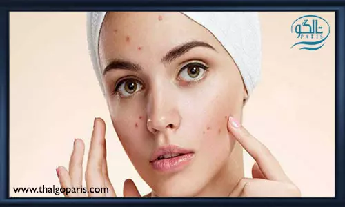 انواع پاک کننده های آرایشی برای رفع جوش