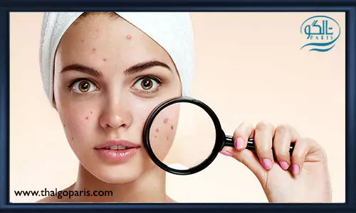 نحوه مراقبت از پوست چرب در زمان بارداری