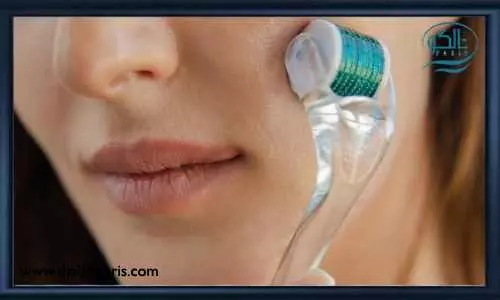 پاکسازی پوست با میکرونیدلینگ