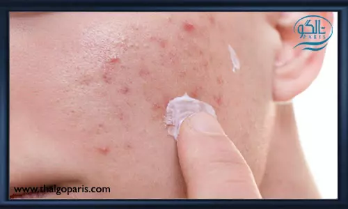 ضد آفتاب های مناسب برای پوست های مستعد آکنه