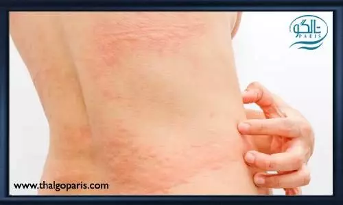 تاثیرات بیماری کووید 19 بر روی پوست