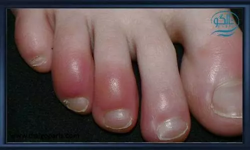 پیشگیری از مشکلات پوستی در زمان بیماری کویید 19