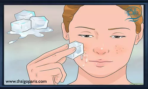 توصیه های مهم در خصوص درمان جوش