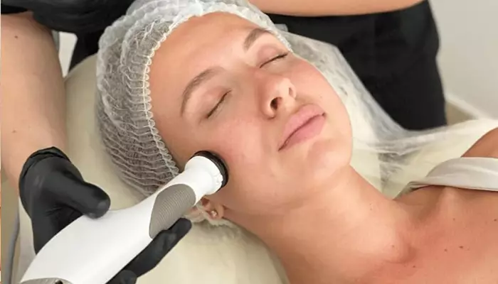 درمان سیاهی دور چشم با لیزر