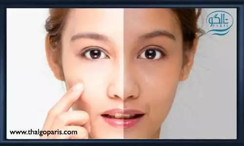 کاربردهای کرم ضد لک