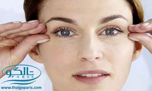برطرف کردن چین و چروک دور چشم