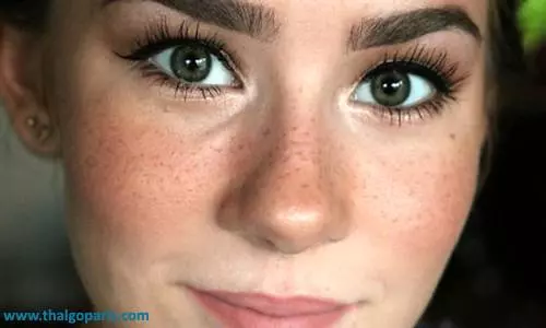 درمان کک و مک و علت ایجاد کک و مک بر روی پوست