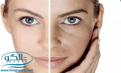 روشن سازی پوست تیره صورت و بدن