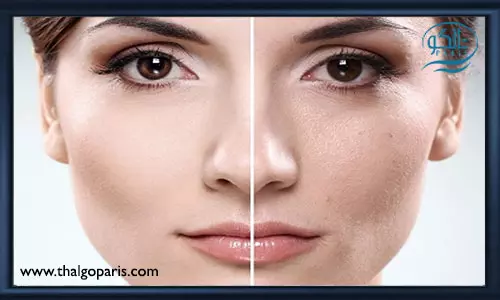 کاربردهای فیس آپ برای لایه برداری پوست