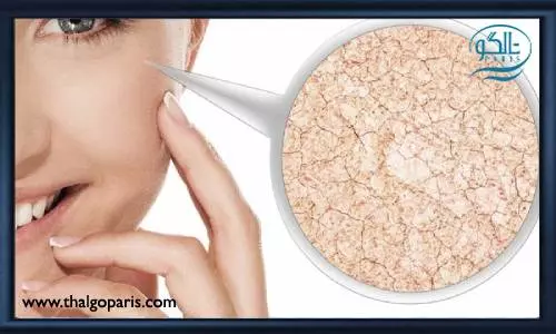 رفع ترک های پوستی و جای جوش با کلاژن