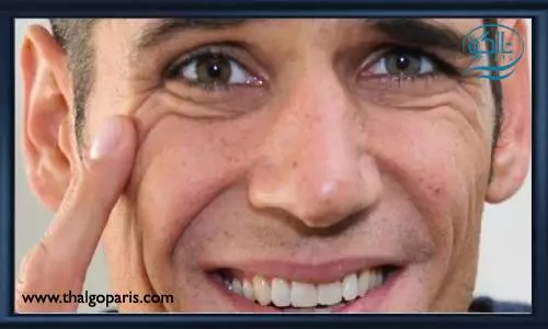 چین و چروک زودرس بر اثر استعمال دخانیات