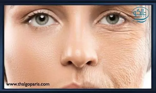 تاثیر لایه برداری در کلاژن سازی پوست