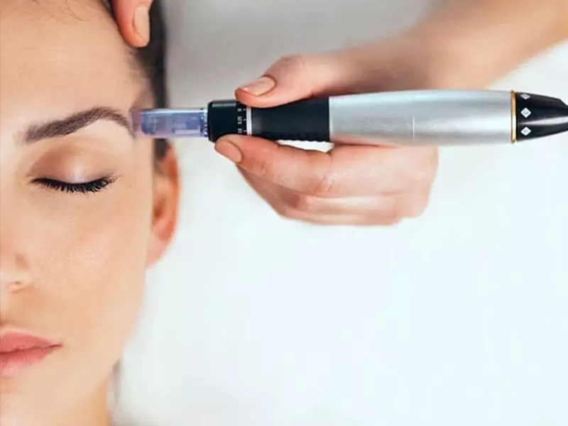 دورههای آموزشی میکرونیدلینگ در تهران