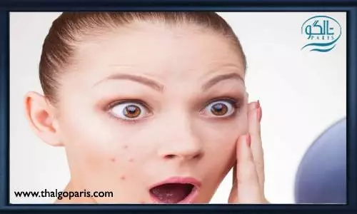 دلایل جوش های ناگهانی در صورت